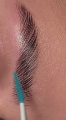 Eyebrow Lift