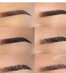 eyebrow peeling