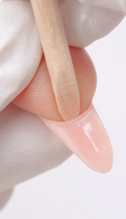 Gel poly Removal