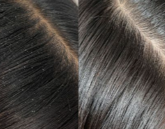 Kinzy Scalp Detox